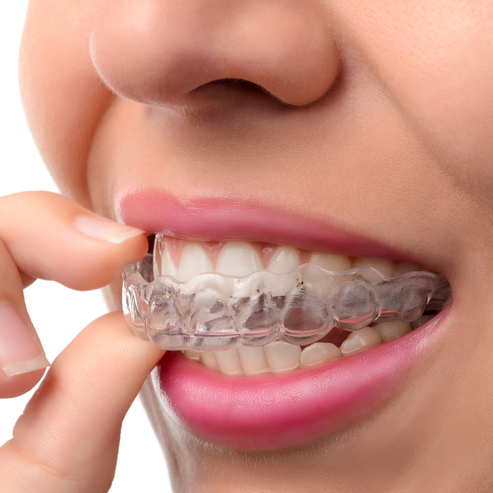 mujer-usa-tratamiento-ortodoncia-invisalign